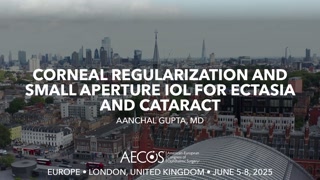 111 - Corneal Regularization and Small Aperture IOL for Ectasia and Cataract - Aanchal Gupta, MD [1106548082].mp4